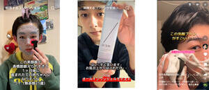 �i�ʐ^�����j�{���P�āA�~�џ���A�����E��